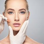 Servicio de Botox