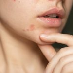 Dermatologia
