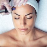 Mesoterapia facial